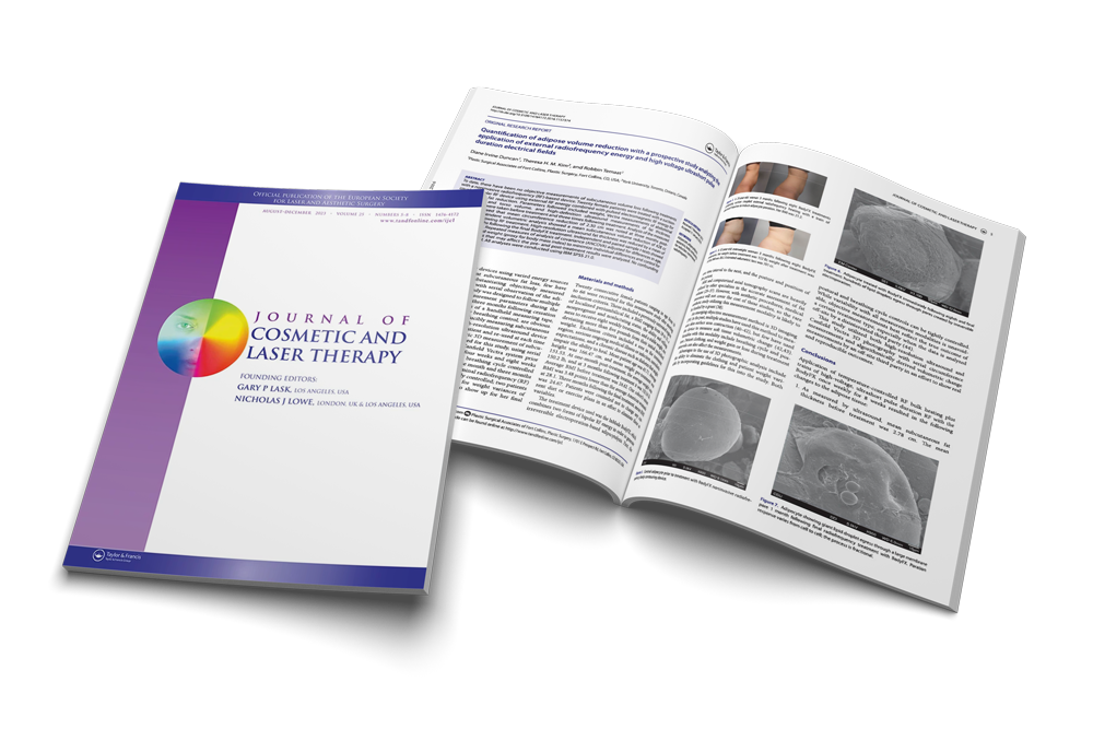 Quantification of adipose volume reduction with a prospective study analyzing the application of external radiofrequency energy and high voltage ultrashort pulse duration electrical fields