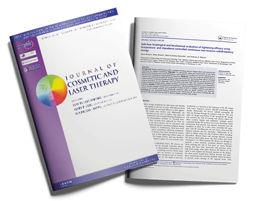 Split-face histological and biochemical evaluation of tightening efficacy using temperature- and impedance-controlled continuous non-invasive radiofrequency energy