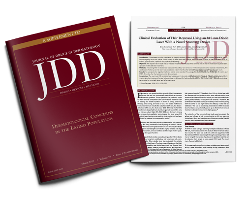 Clinical Evaluation of Hair Removal Using an 810 nm Diode Laser With a Novel Scanning Device