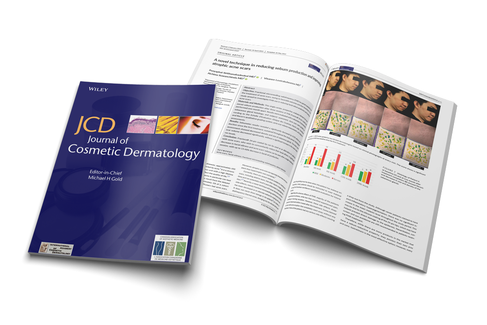 A novel technique in reducing sebum production and improving atrophic acne scars