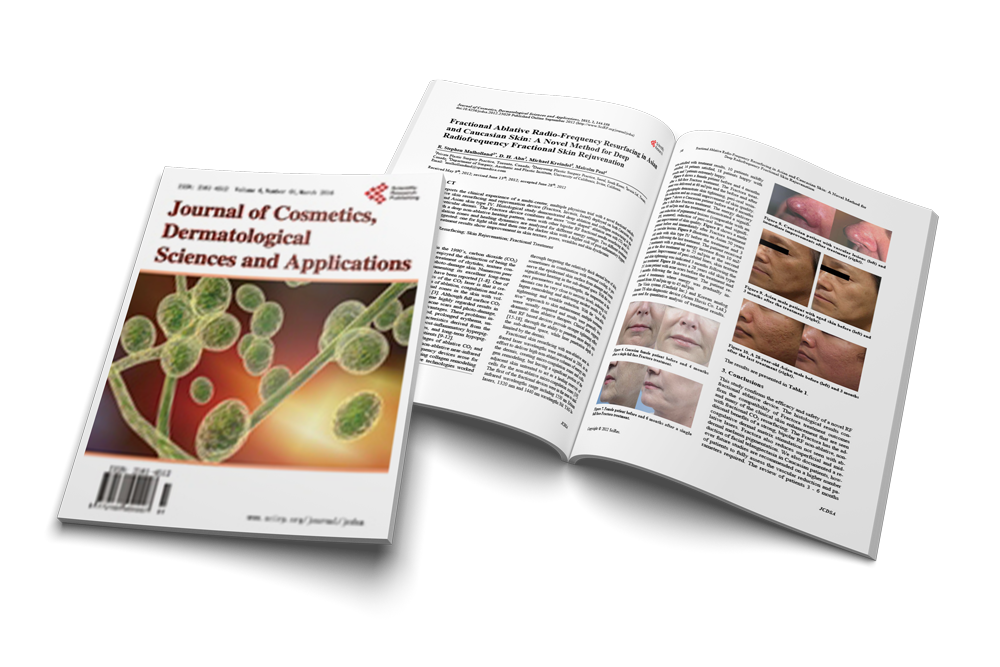 Fractional Ablative Radio-Frequency Resurfacing in Asian and Caucasian Skin: A Novel Method for Deep Radiofrequency Fractional Skin Rejuvenation