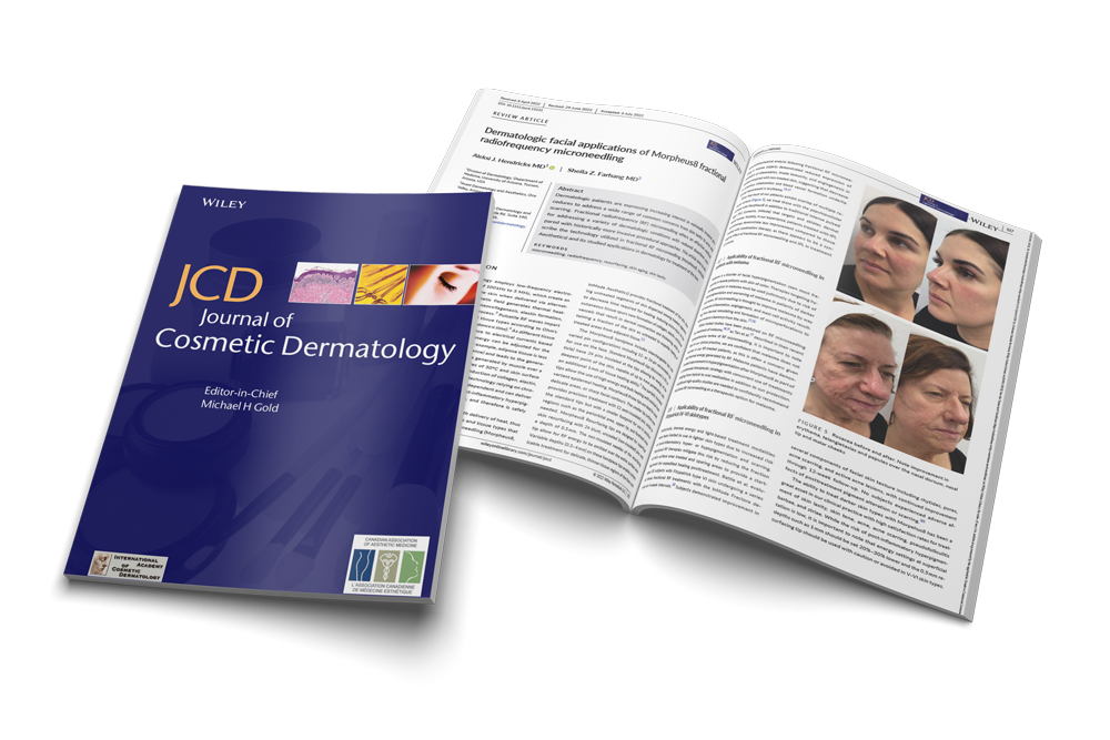 Dermatological facial applications of Morpheus8 fractional radiofrequency microneedling