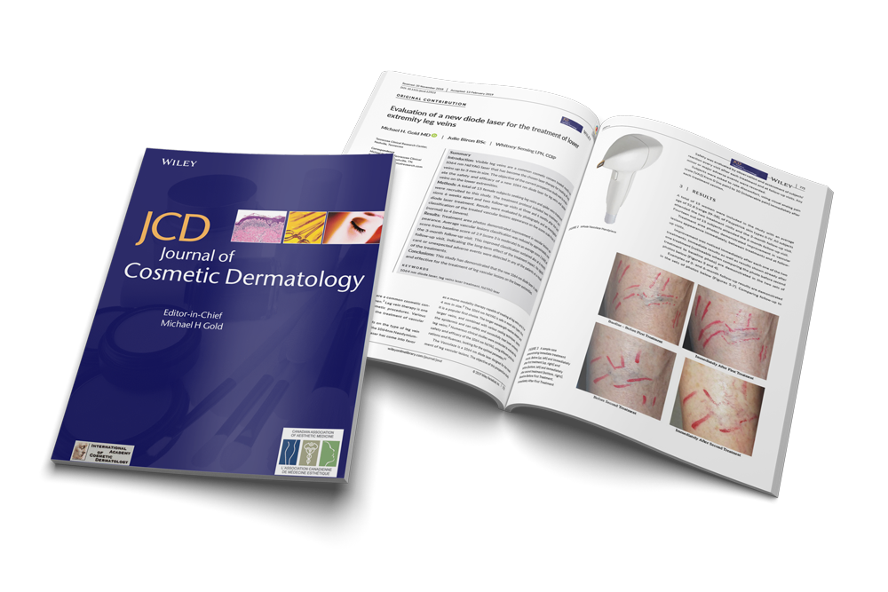 Evaluation of a new diode laser for the treatment of lower extremity leg veins