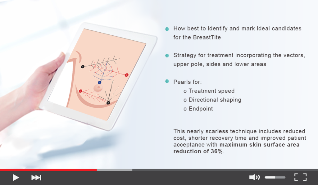 Live Demo: Minimally Invasive Breast Lift with BreastTite  - Dr. Diane Duncan