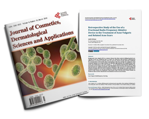 Retrospective Study of the Use of a Fractional Radio Frequency Ablative Device in the Treatment of Acne Vulgaris and Related Acne Scars