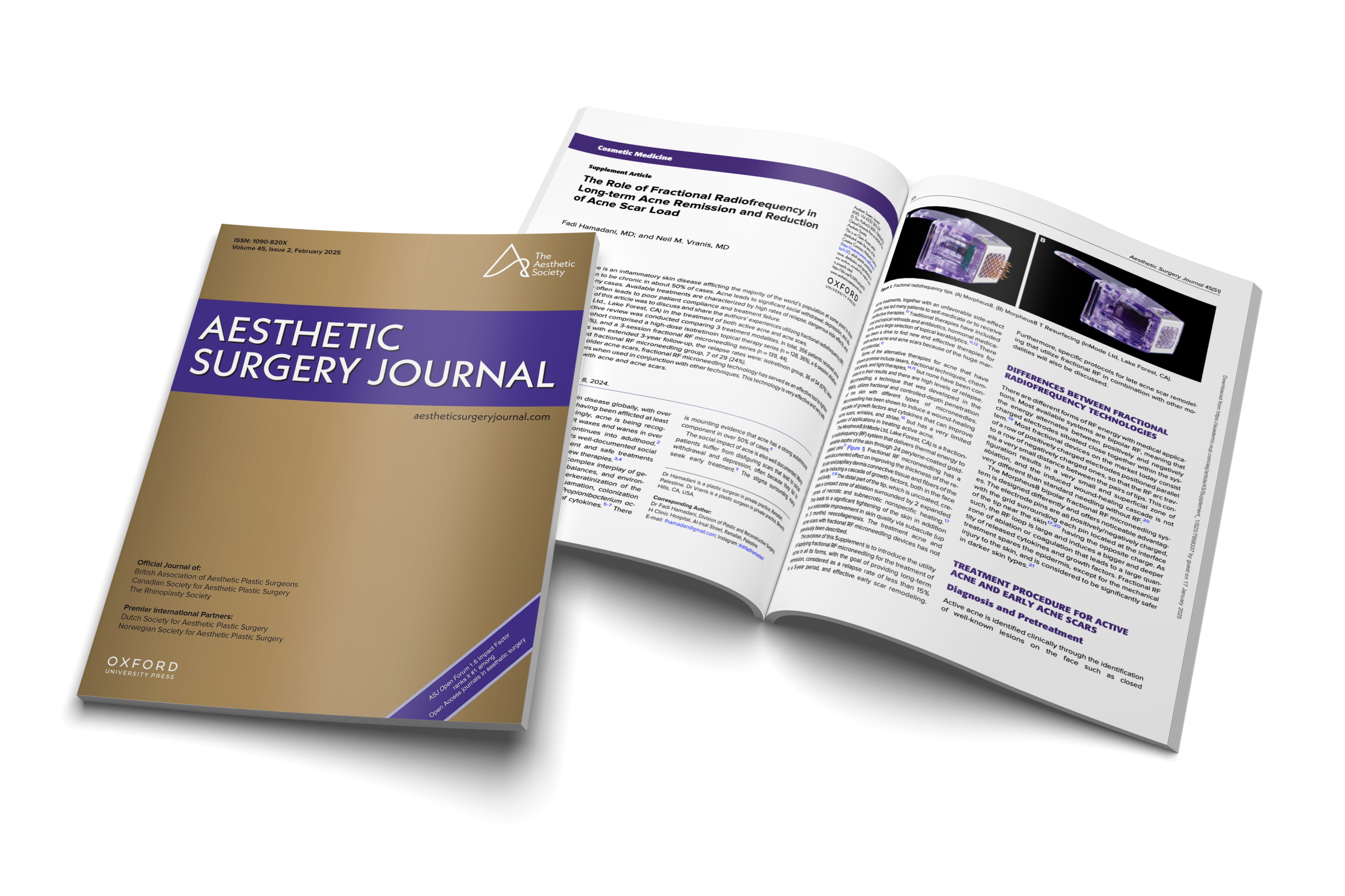 The Role of Fractional Radiofrequency in Long-term Acne Remission and Reduction of Acne Scar Load