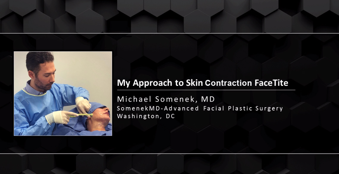 Webinar: FaceTite Skin Contraction Patient Case Studies – Dr. Michael Somenek