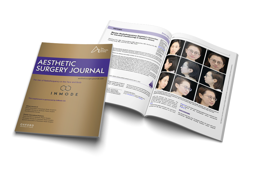 Bipolar Radiofrequency-Assisted Liposuction for Cervical Contouring in Eastern Asians