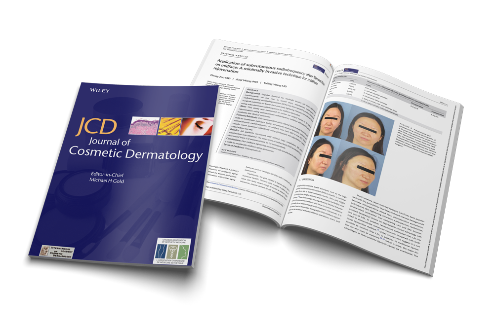 Application of subcutaneous radiofrequency after liposuction on midface: A minimally invasive technique for midface rejuvenation