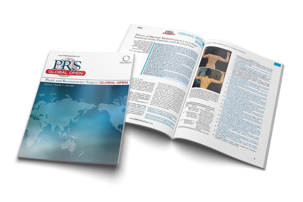 Effects of Bipolar Radiofrequency on Collagen Synthesis from Patients with Brachial Ptosis