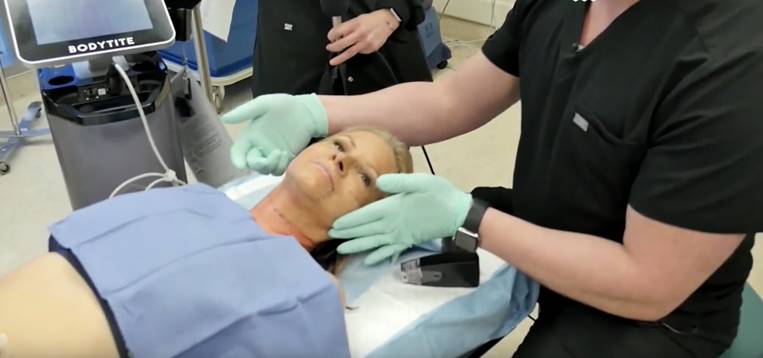 Live Demo: Non-Surgical Skin Tightening with Morpheus8 RF – David Weir, NP-C