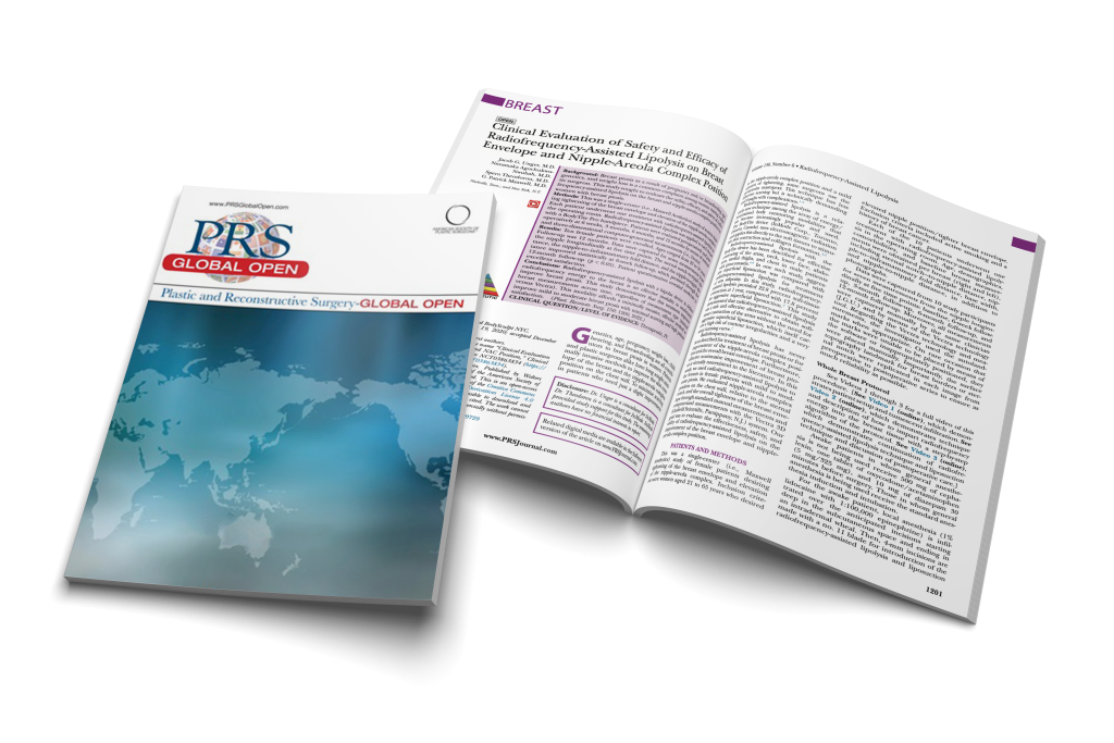 RFAL BreastTite for Ptosis Treatment
