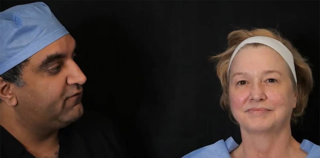 Live Demo: Eyelid Rejuvenation with AccuTite & Morpheus8 Prime - Dr. Sean Paul