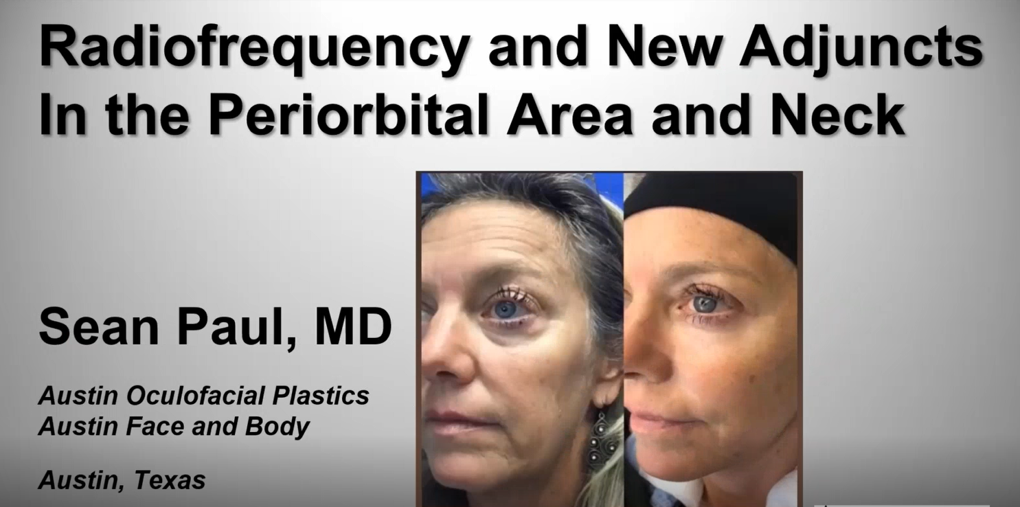 Webinar: Lower Eyelid Rejuvenation with AccuTite & Morpheus8 – Dr. Sean Paul, Dr. Spero Theodorou