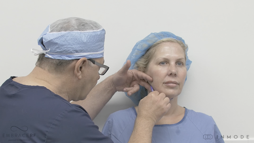 Live Demo: Face & Neck Contouring with FaceTite & Morpheus8 - Dr. Nicholos Nikolov