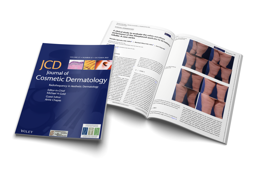 Treating Cellulite with Morpheus8 RF