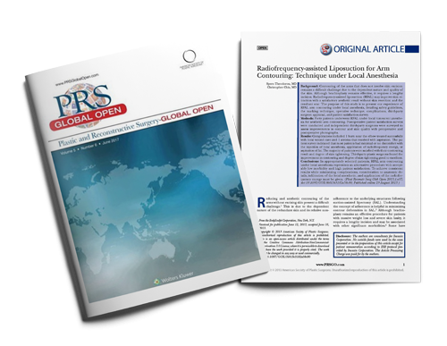 Radiofrequency-assisted Liposuction for Arm Contouring: Technique under Local Anesthesia