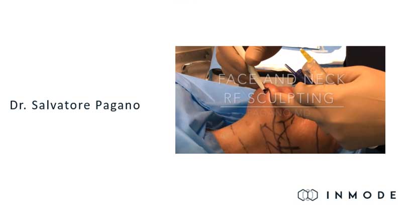 Adding BodyTite to your Plastic Surgery Practice  – Dr. Salvatore Pagano