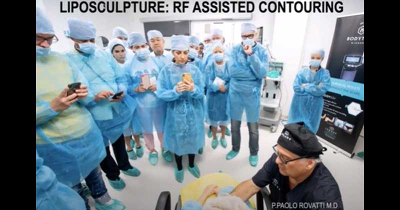 Live Demo: Advanced BodyTite Techniques for RF Body Contouring – Dr. Paolo Rovatti