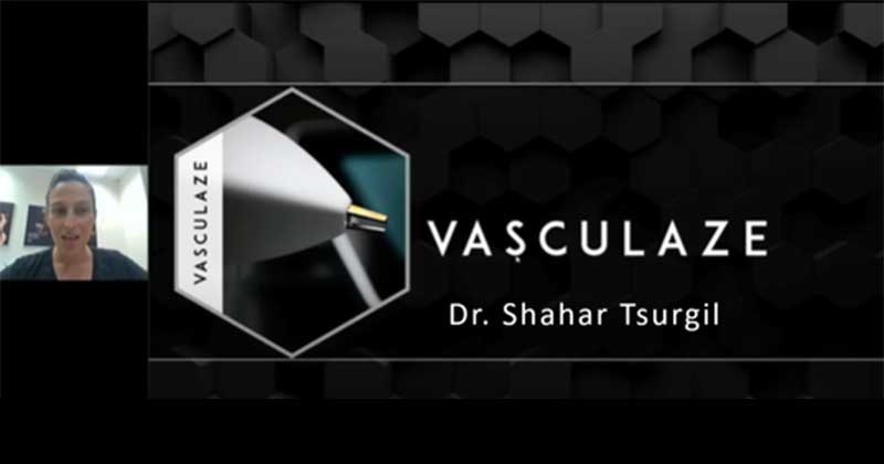 Vasculaze Treatment for Vascular Lesion Removal | Dr. Tsurgil – Dr. Shahar Tsurgil