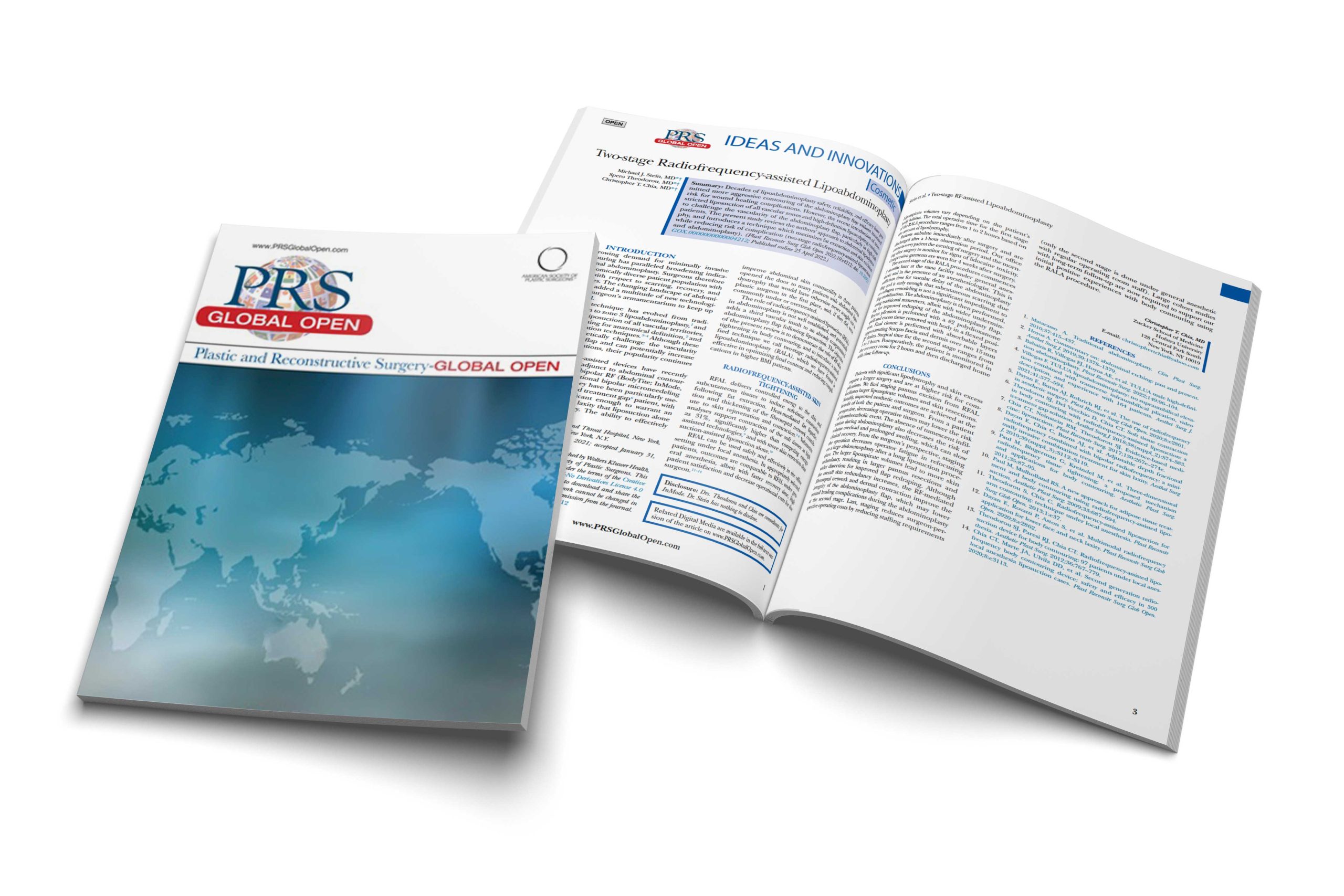 Two-stage Radiofrequency-assisted Lipoabdominoplasty