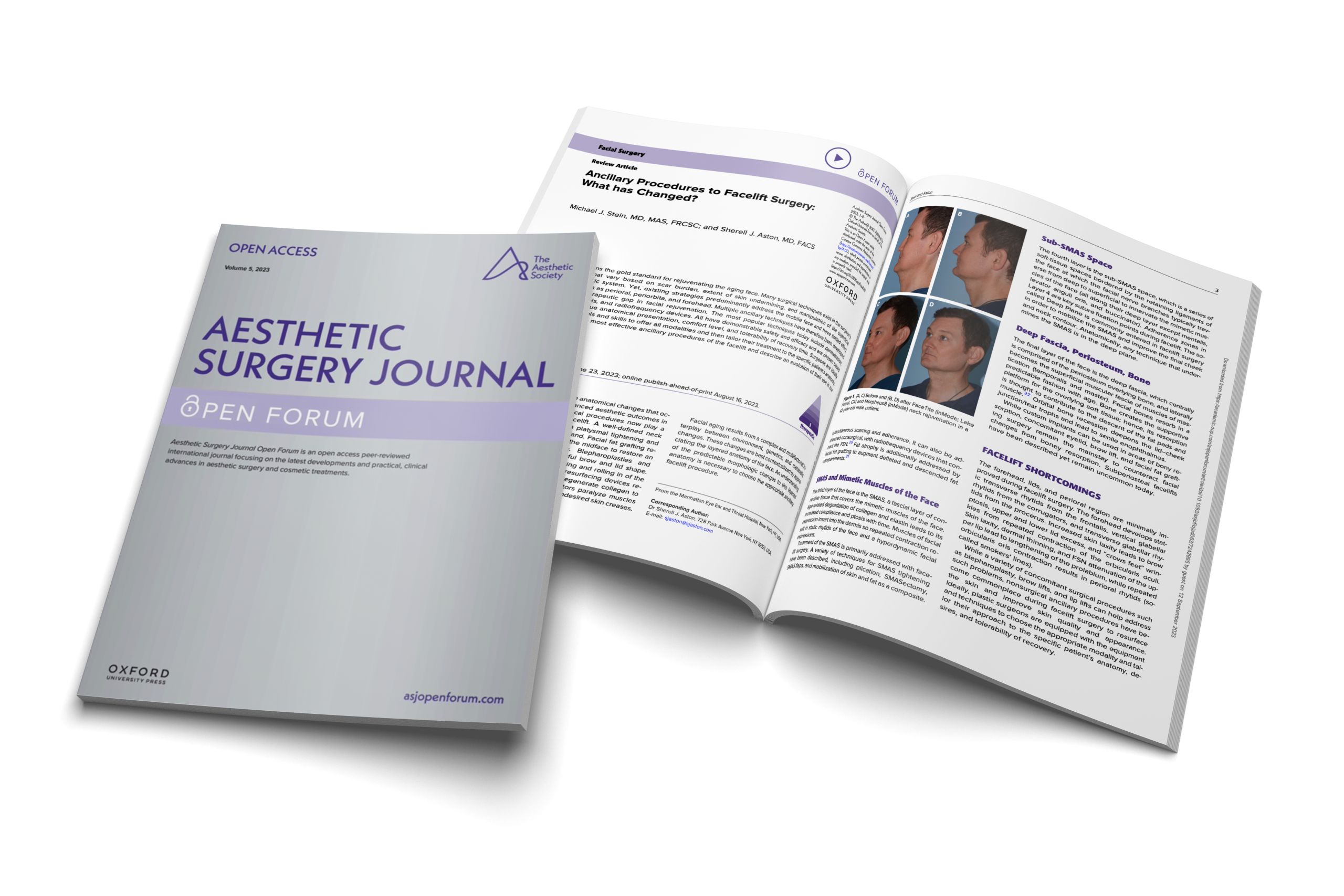 Ancillary Procedures to Facelift Surgery: What has Changed?