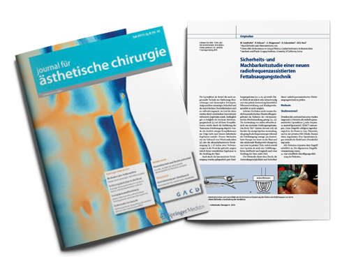 Sicherheits- und Machbarkeitsstudie einer neuen radiofrequenzassistiertenm Fettabsaugungstechnik