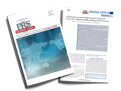 Radiofrequency-Assisted Liposuction For Neck And Lower Face Adipodermal Remodeling And Contouring
