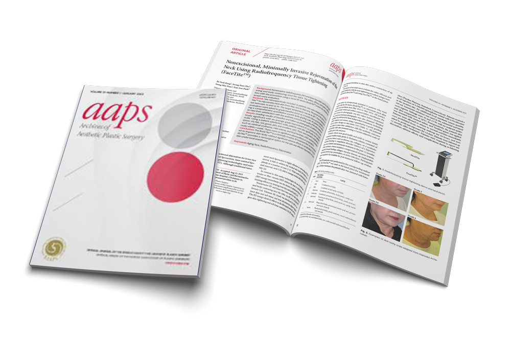 Nonexcisional, Minimally Invasive Rejuvenation of the Neck Using Radiofrequency Tissue Tightening (FaceTite)