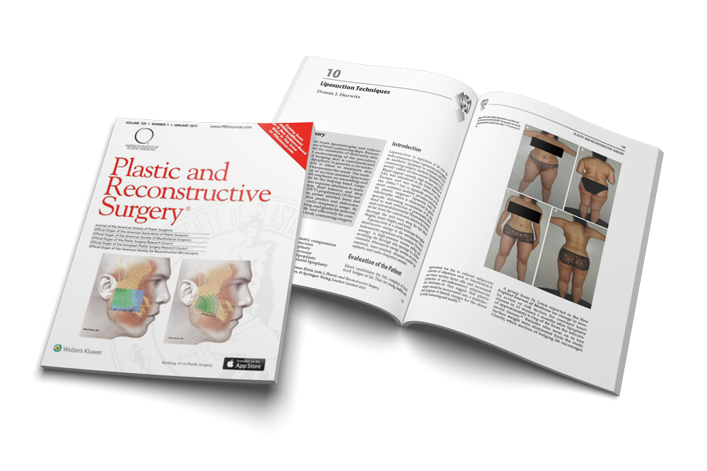 Liposuction Techniques