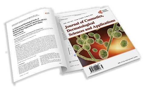 A Clinical and Histological Study of Radiofrequency-Assisted Liposuction (RFAL) Mediated Skin Tightening and Cellulite Improvement
