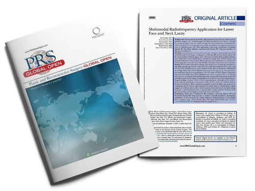 Multimodal Radiofrequency Application for Lower Face and Neck Laxity