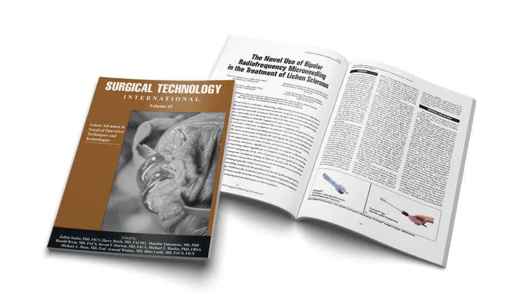 Morpheus8V as a treatment for Lichen Sclerosus