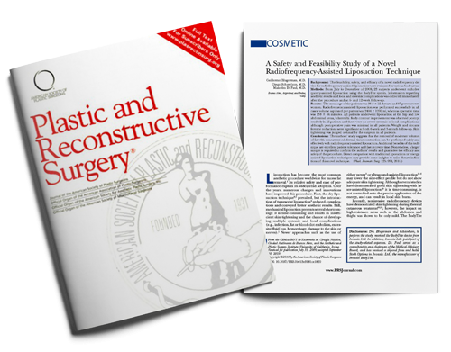 A Safety and Feasibility Study of a Novel Radiofrequency-Assisted Liposuction Technique