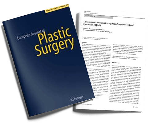 Gynecomastia Treatment Using Radiofrequency-Assisted Liposuction (RFAL)