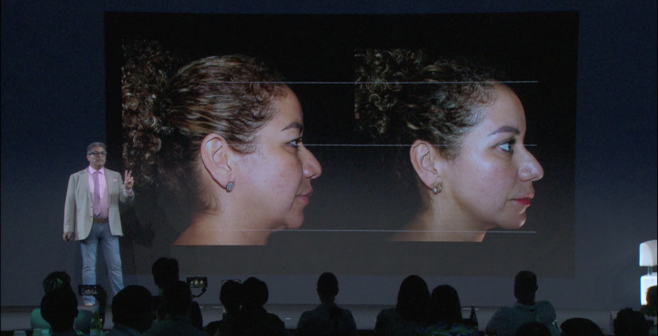 Webinar: New QuantumRF Technology for Soft Tissue Contraction – Dr. Alfredo Hoyos