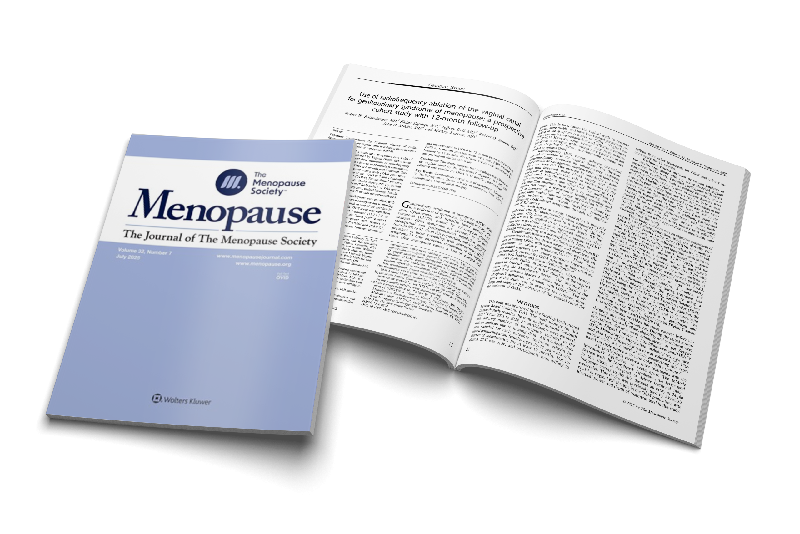 Use of radiofrequency ablation of the vaginal canal for genitourinary syndrome of menopause: a prospective cohort study with 12-month follow-up